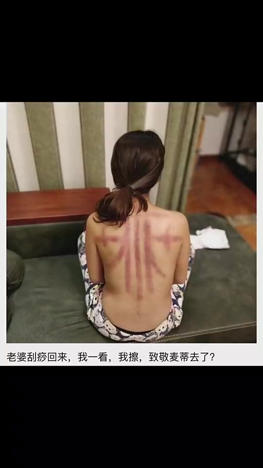 老婆这刮痧是去致敬麦迪吗还真有点像啊 老婆这刮痧是去致敬麦迪吗还真有点像啊
